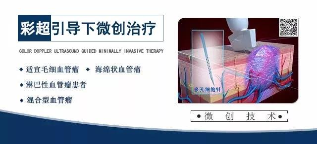 彩超引导下微创治疗血管瘤，彩超引导治疗血管瘤，昆明微创治疗血管瘤