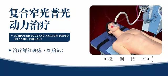 复合窄光普光动力治疗鲜红斑痣，治疗鲜红斑痣，昆明治疗血管瘤