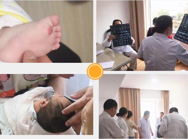 血管瘤·脉管畸形&专家联合会诊活动